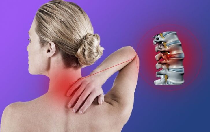 Bizkarrezurraren hantura osteochondrosis cervikoarekin
