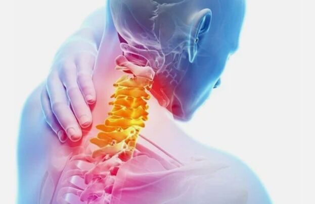 Cervical eskualdeko osteokondrosia