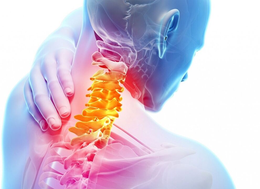 Zer da Cervical Osteokondrosia