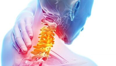 Osteokonondrosaren cervikalaren arrazoiak