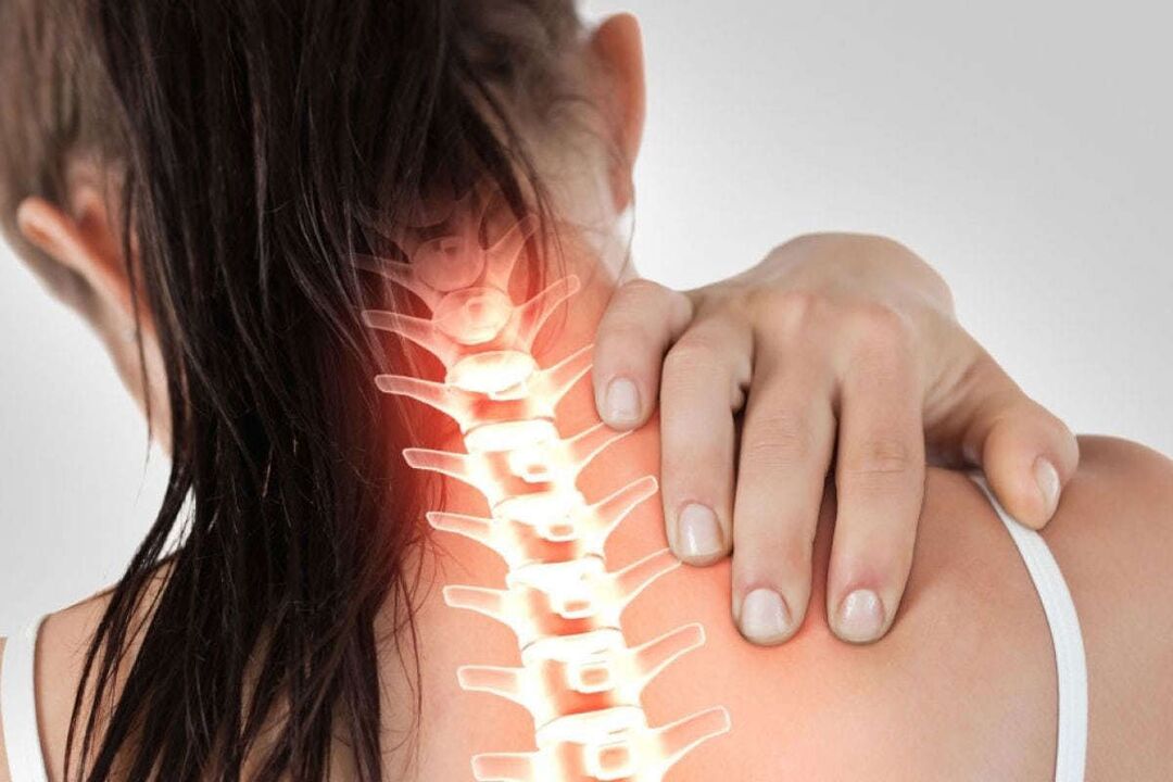 Osteokonondrosaren cervikalaren adierazpenak